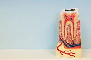 Root Canal Dentist in Fuquay