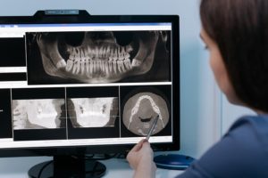 fuquay varina dentist oral cancer screening